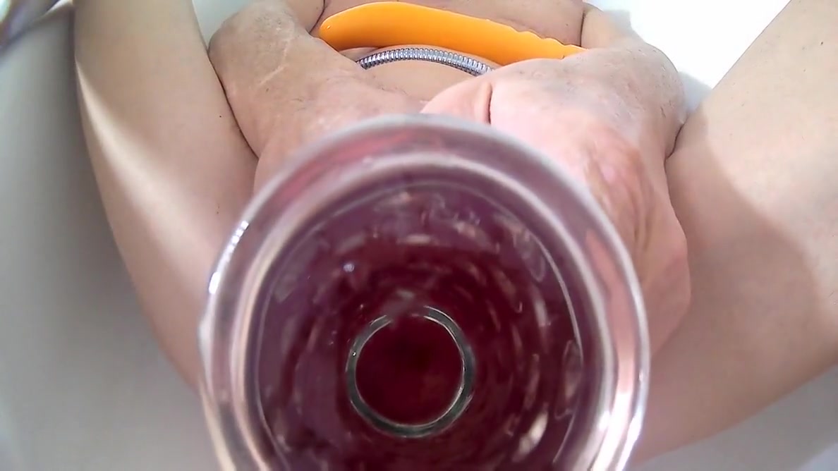 Lizzy Yum In Speculum Dildo And Post Op Pussy Stretching